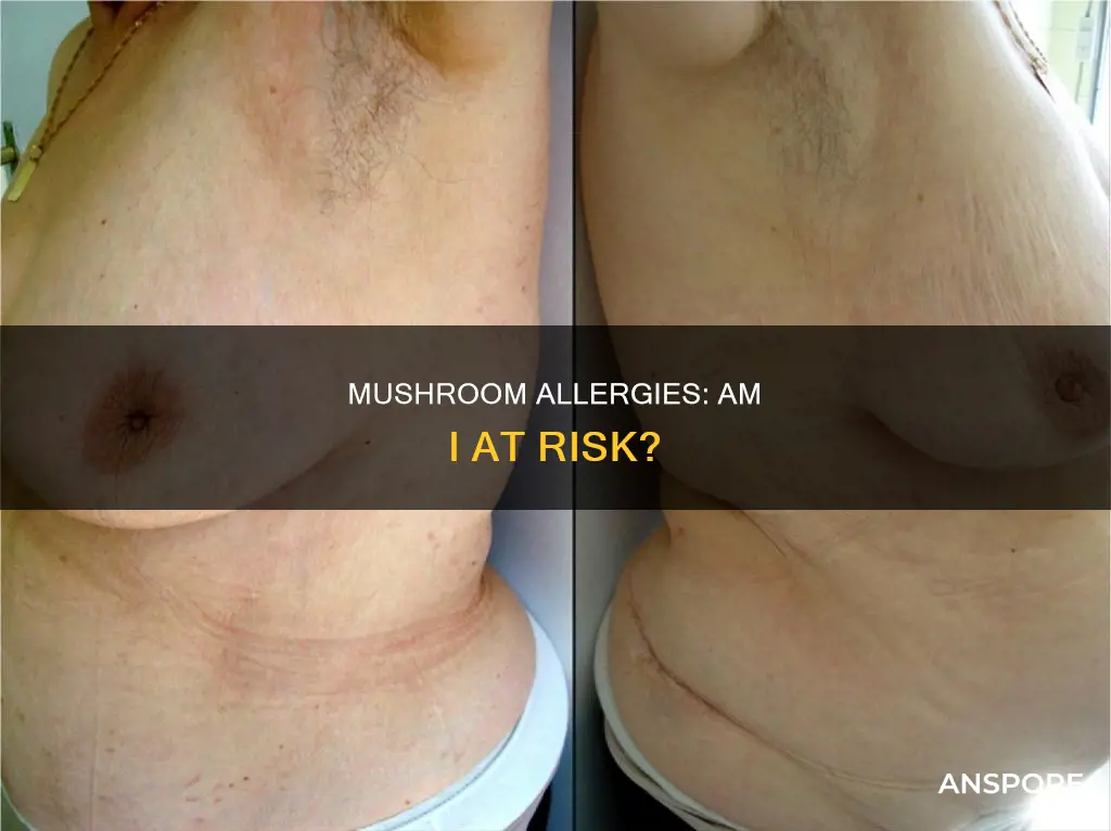 am i allergic to mushrooms