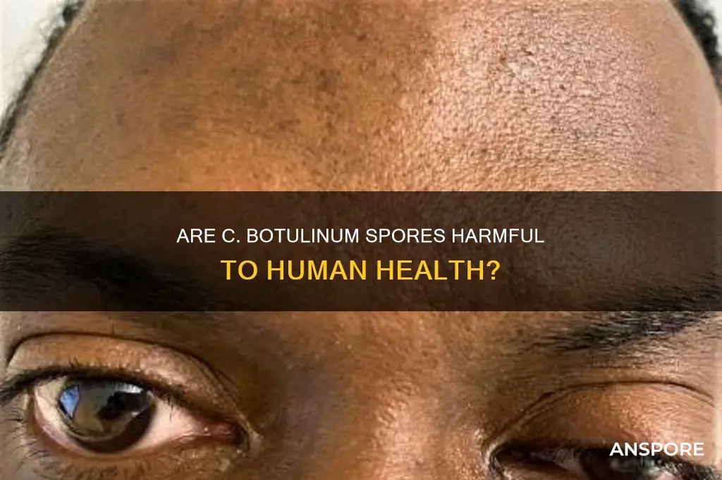 are c botulinum spores toxic to humans