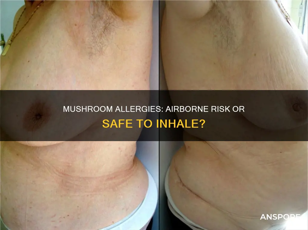 are mushroom allergies airborne