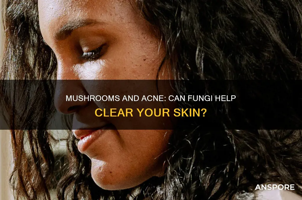 are mushrooms a good food for preventing acne