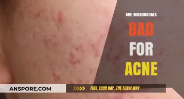 Mushrooms and Acne: Unveiling the Truth Behind Their Impact on Skin