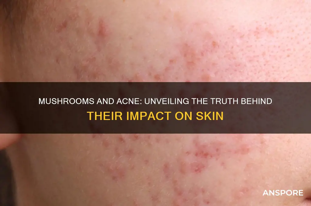 are mushrooms bad for acne