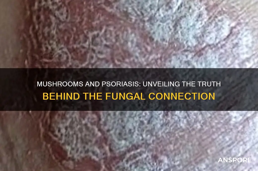 are mushrooms bad for psoriasis