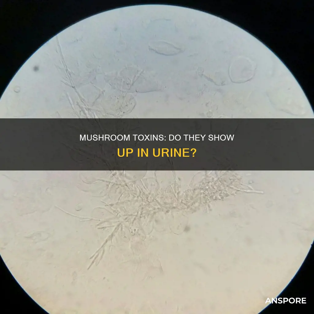 are mushrooms detectable in urine