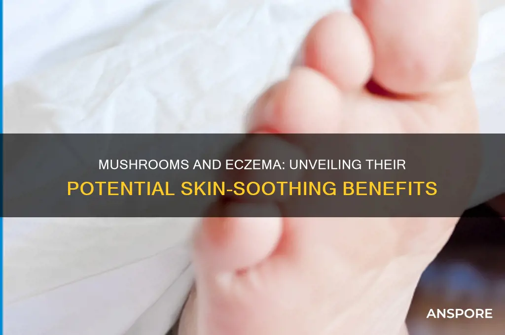 are mushrooms good for eczema