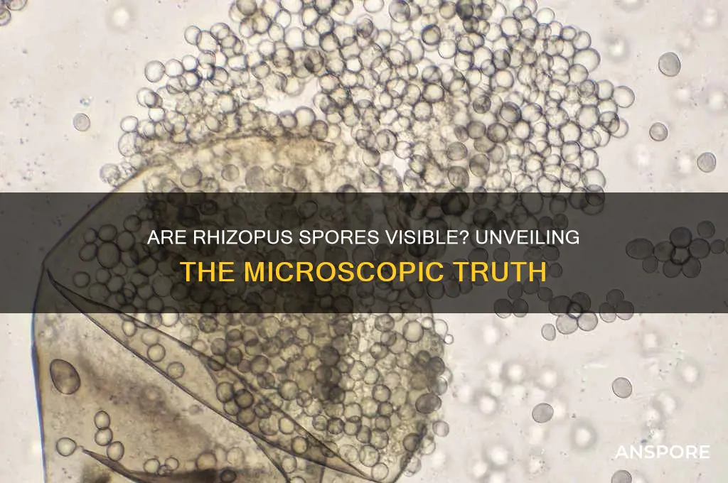 are rhizopus spores visible
