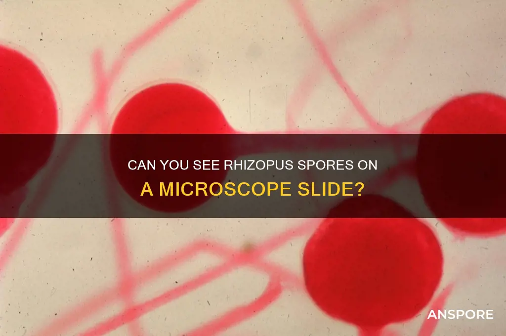 are spores visible on the slide of rhizopus