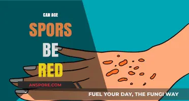 Can Age Spots Be Red? Understanding Skin Discoloration Causes and Treatments