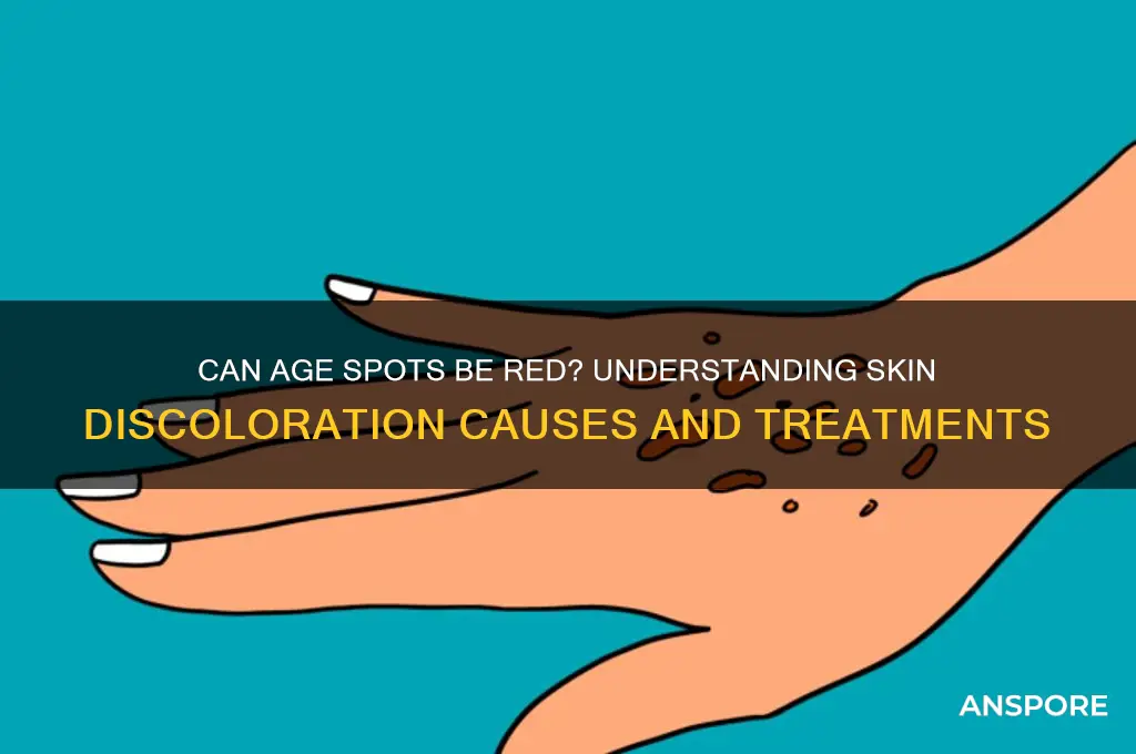 can age spors be red