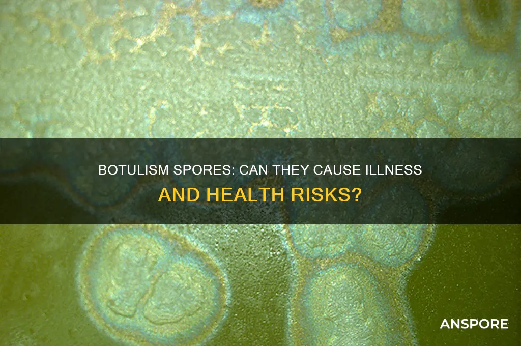 can botulism spores make you sick