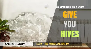 Can Mold Spores Trigger Hives? Understanding the Link and Risks