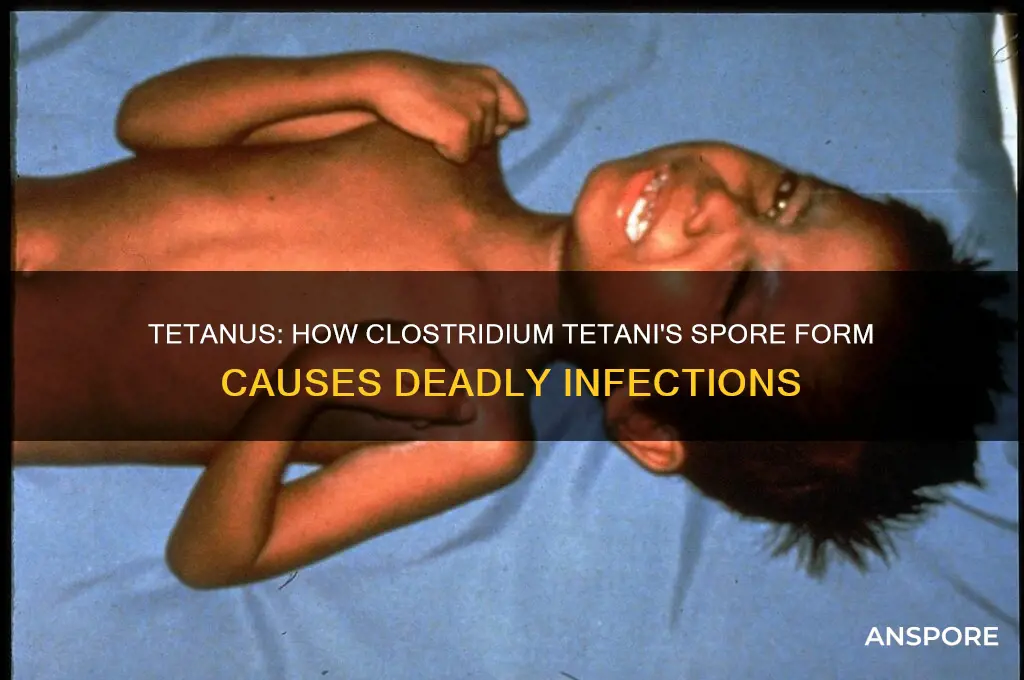 can exist in the spore form and cause tetanus