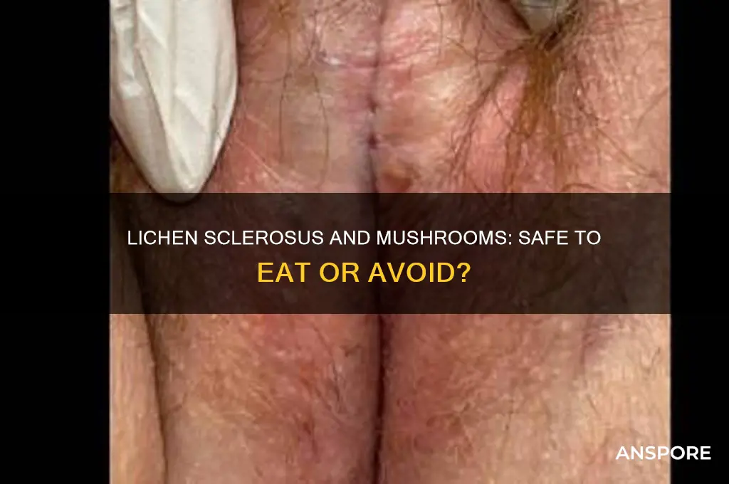 can i eat mushrooms if i have lichen sclerosus
