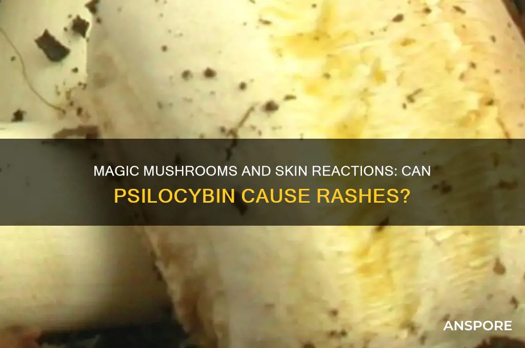 can magic mushrooms give you a rash