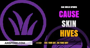 Can Mold Spores Trigger Skin Hives? Understanding the Allergic Reaction