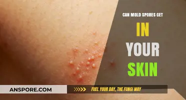 Can Mold Spores Penetrate Your Skin? Facts and Prevention Tips