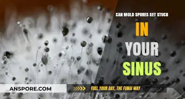 Mold Spores in Sinuses: Causes, Symptoms, and Effective Treatment Options