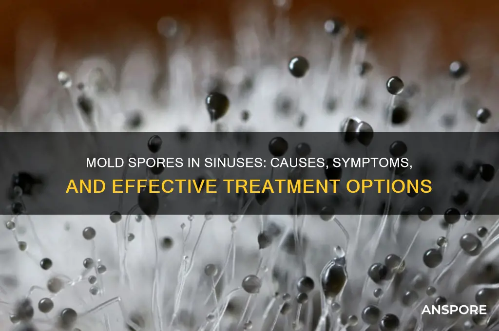 can mold spores get stuck in your sinus