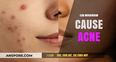Mushrooms and Acne: Uncovering the Truth Behind Skin Breakouts