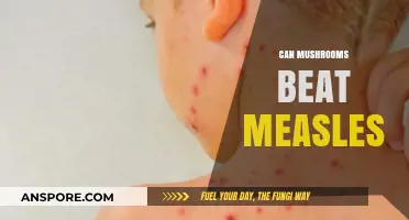 Mushrooms vs. Measles: Exploring the Potential of Fungal Remedies