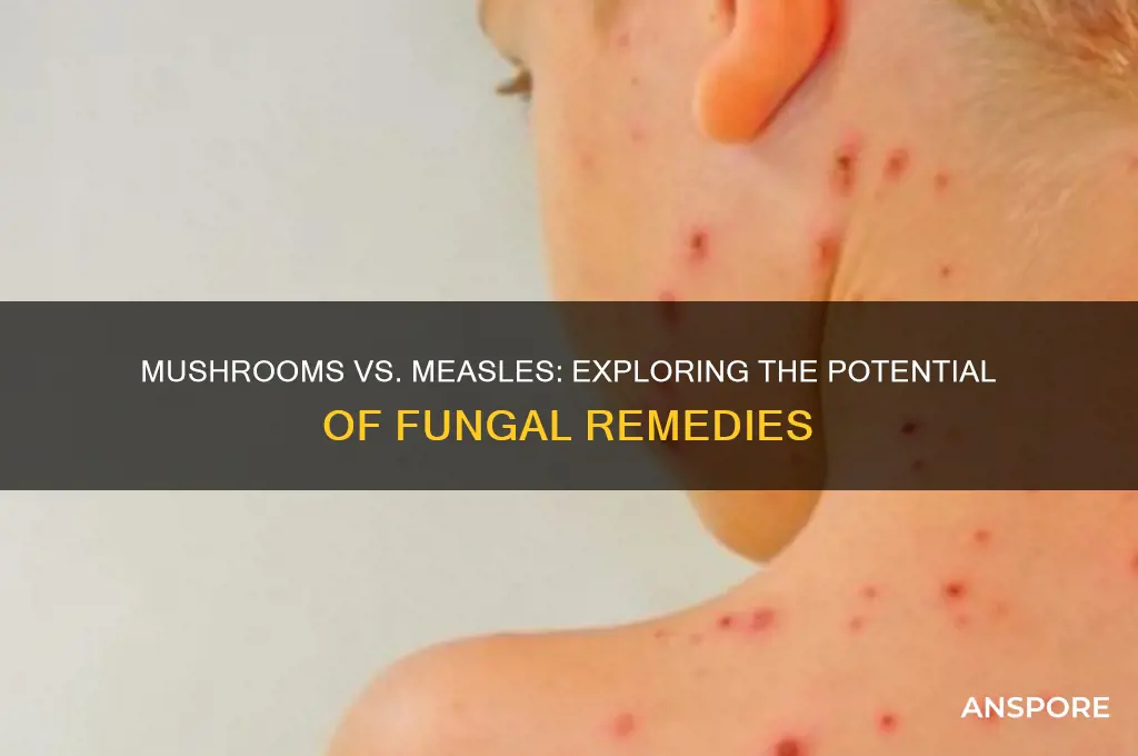 can mushrooms beat measles
