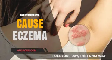 Can Mushrooms Trigger Eczema? Exploring the Fungal-Skin Connection