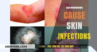 Mushrooms and Skin Infections: Uncovering the Surprising Connection and Risks