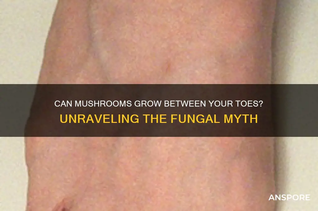 can mushrooms grow between your toes