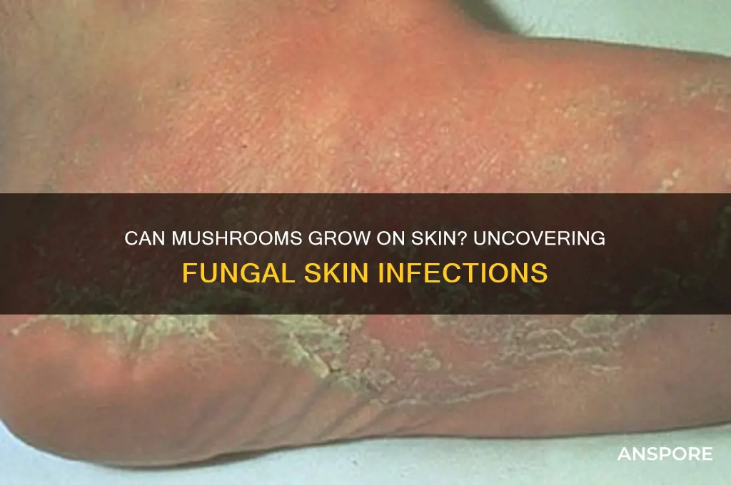 can mushrooms grow on skin