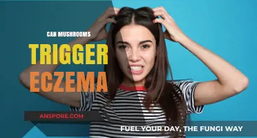 Can Mushrooms Trigger Eczema? Exploring the Fungal-Skin Connection
