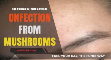 Can Mushroom Exposure Cause Fungal Acne Breakouts? Facts Revealed