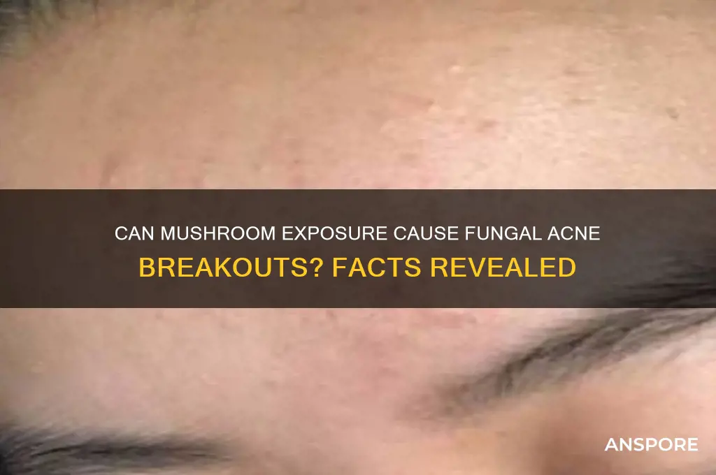 can u break out with a fungal onfection from mushrooms