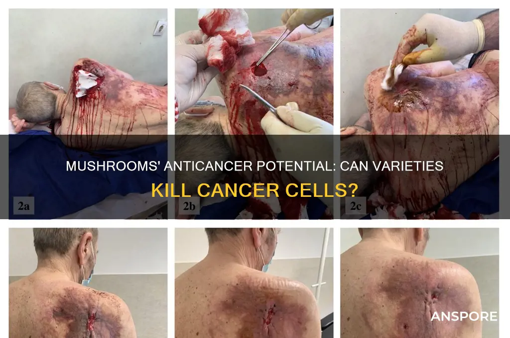 can varieties of mushroom kill cancer cells