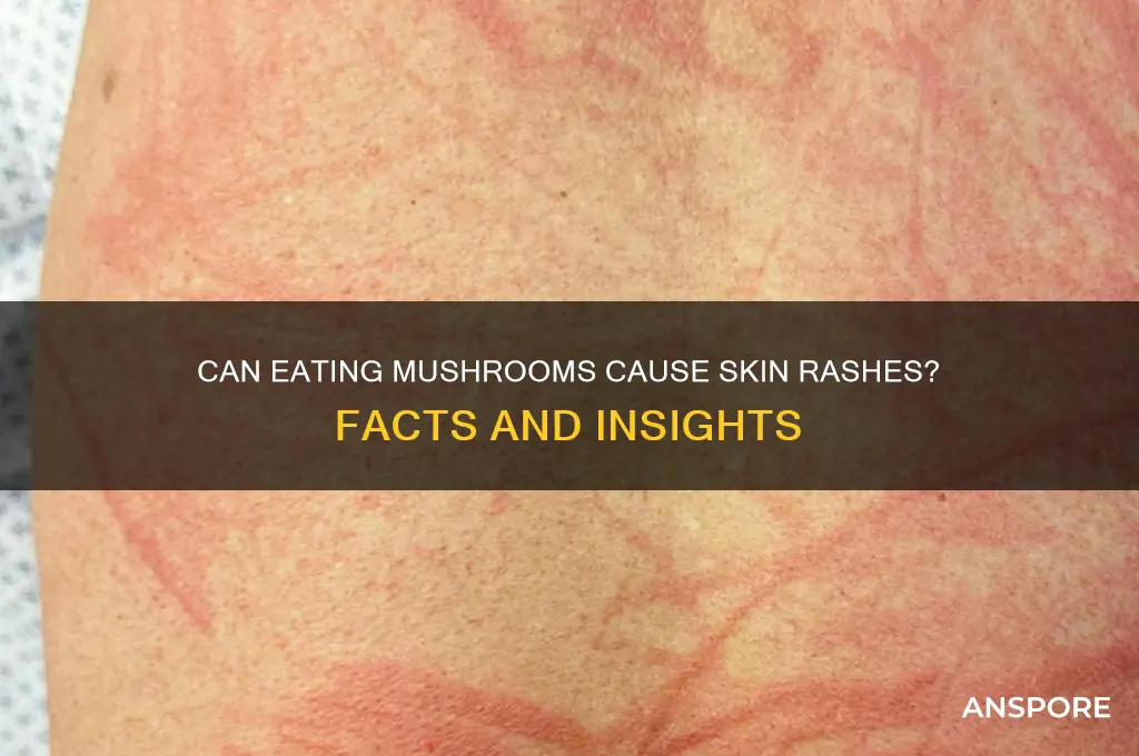 can you get a rash from eating mushrooms