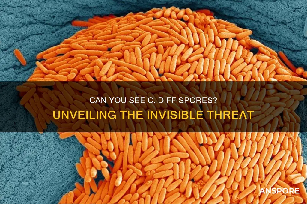 can you see c diff spores