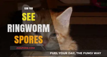 Can You See Ringworm Spores? Unveiling the Invisible Threat