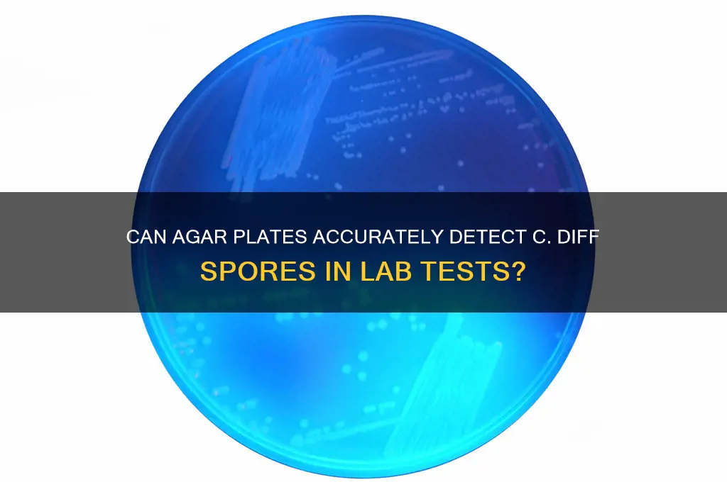 do agar plates detect c diff spores