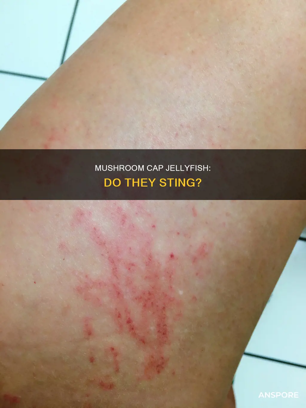 do mushroom cap jellyfish sting