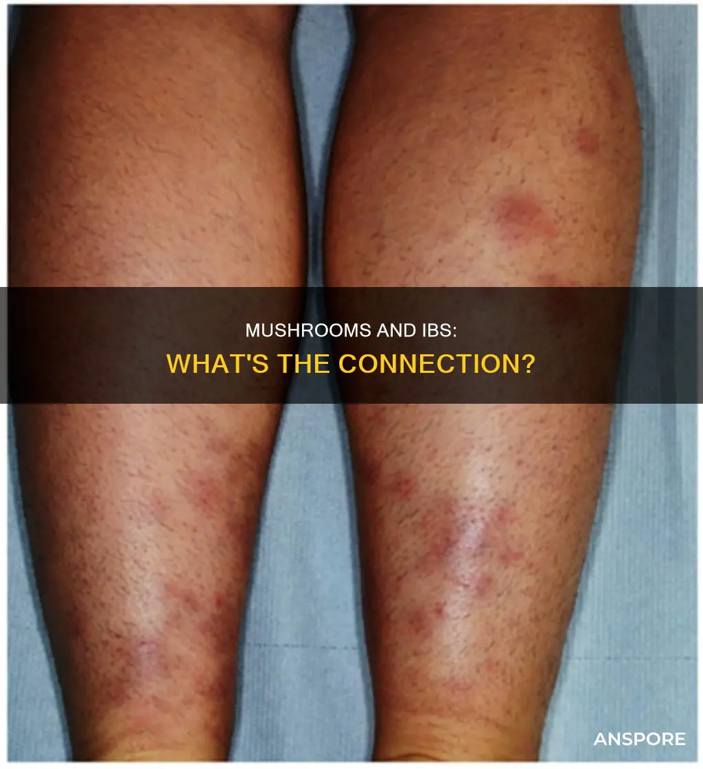 do mushrooms irritate ibs