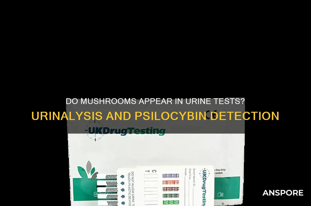 do mushrooms show up on urinalysis