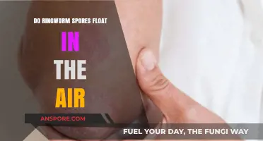 Can Ringworm Spores Float in the Air? Facts and Prevention Tips