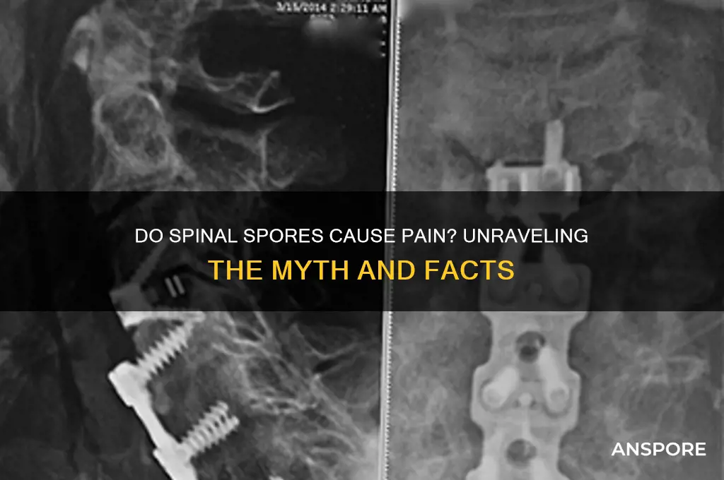 do spores on your spine cause pain