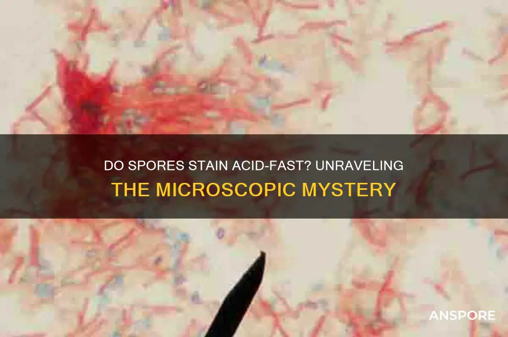 do spores stain with acid fast