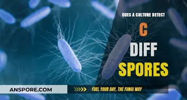 Can Cultures Accurately Detect C. Diff Spores in Clinical Settings?
