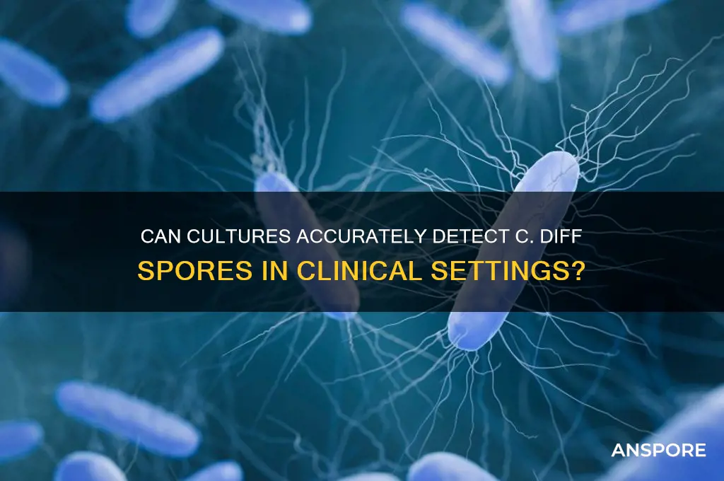 does a culture detect c diff spores