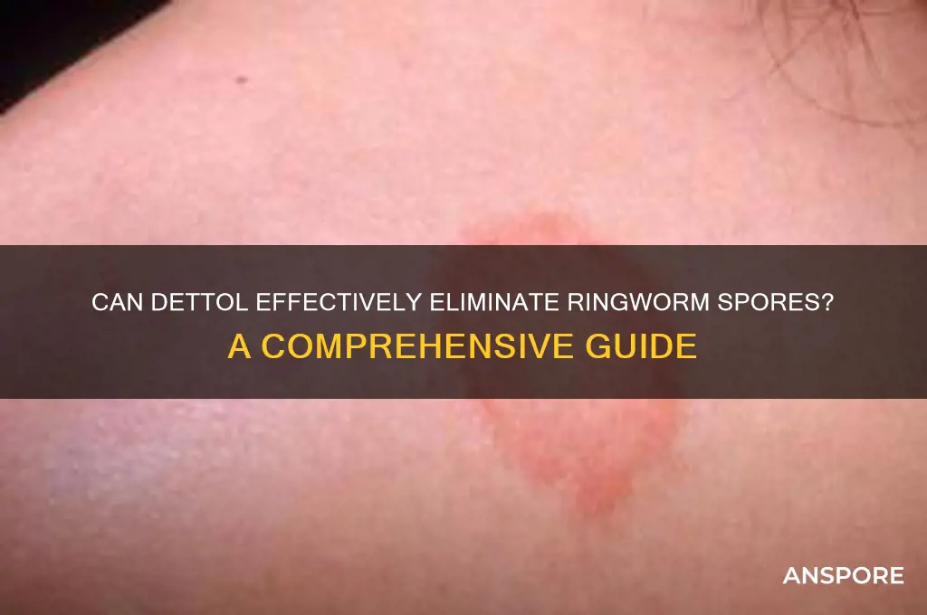 does dettol kill ringworm spores