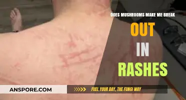Mushrooms and Skin Rashes: Uncovering the Truth Behind the Breakout