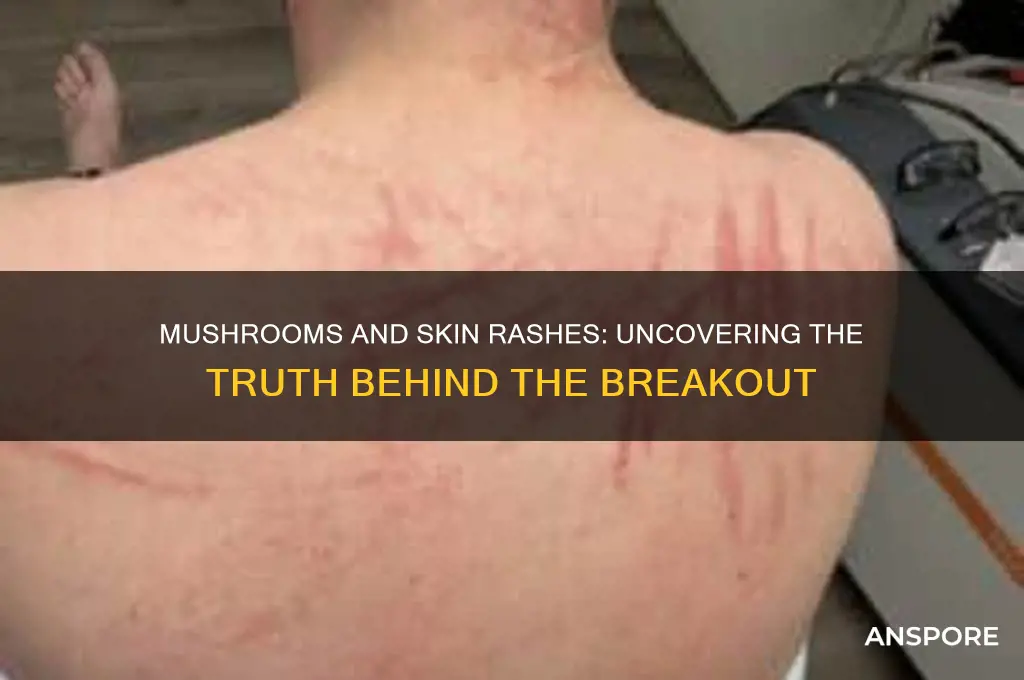 does mushrooms make me break out in rashes