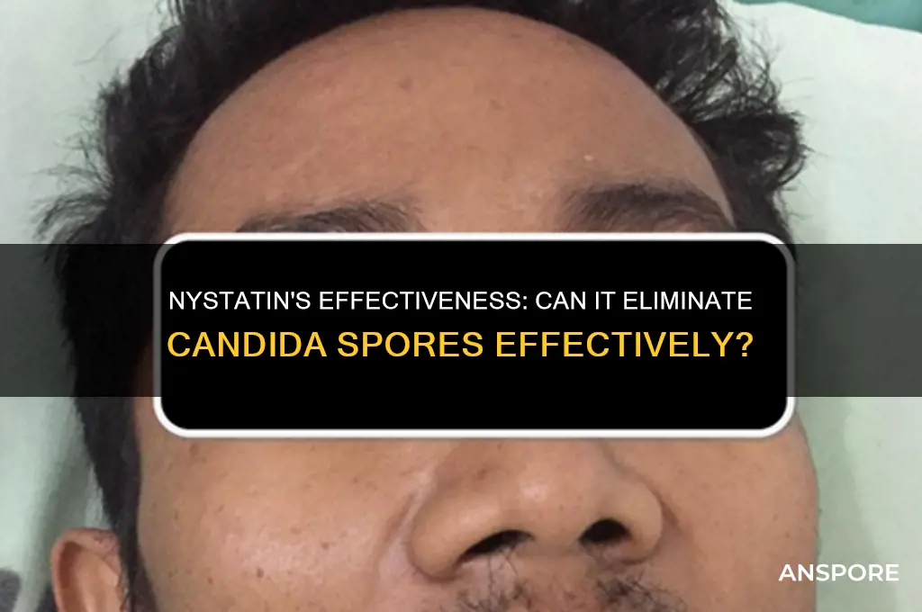 does nystatin kill candida spores