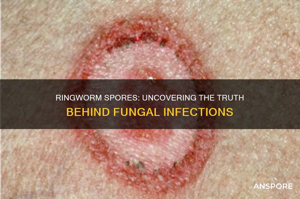 does ringworm have spores